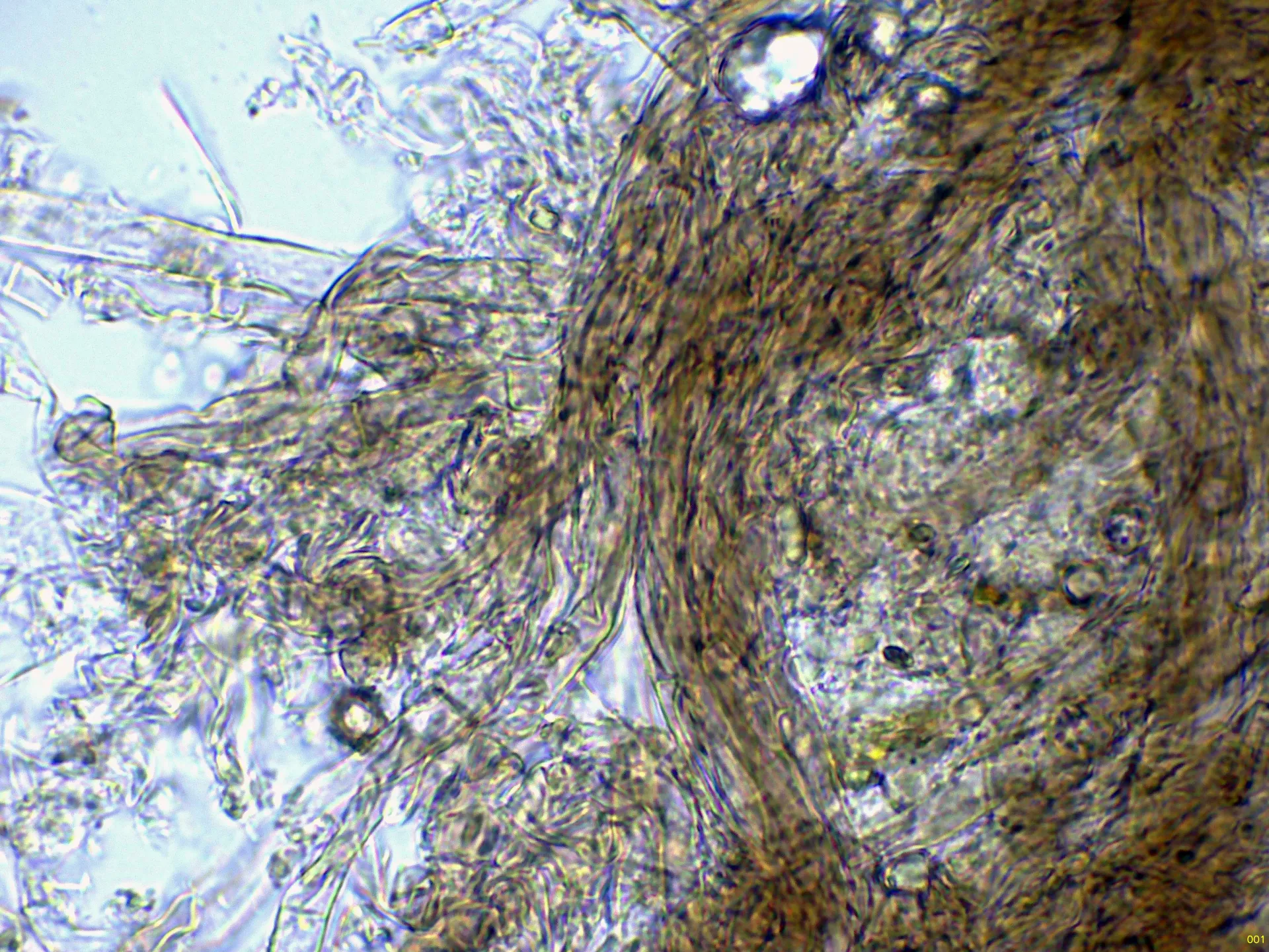 Microscopía de Thelephora anthocephala - 12 - Hifas pie agua-001
